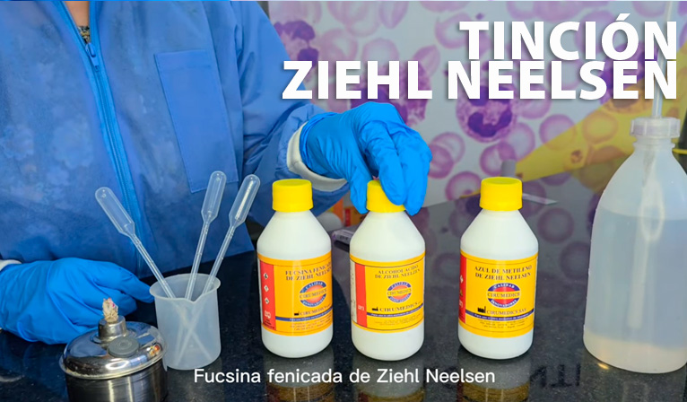 Tinción-Ziehl-Neelsen---cirumedics-