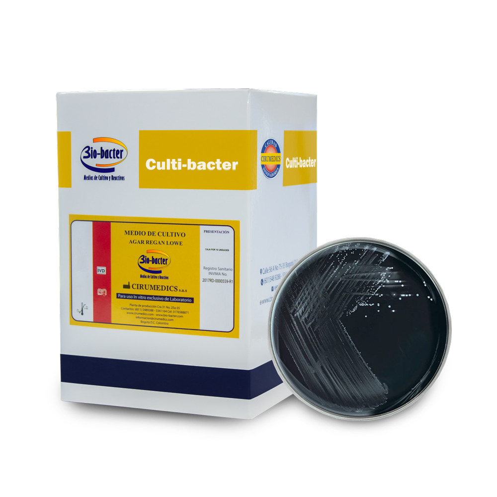 Colonias Bordetella pertussis en Agar Regan Lowe